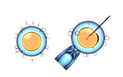 ما الفرق بين الحقن المجهري وأطفال الأنابيب؟