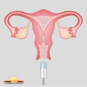 human chorionic gonadotropin